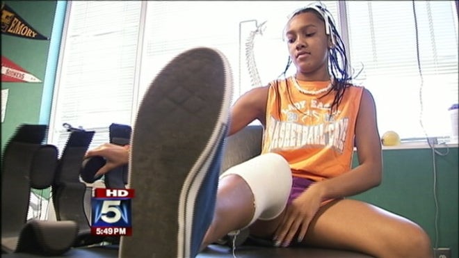Girl knee injury.jpg